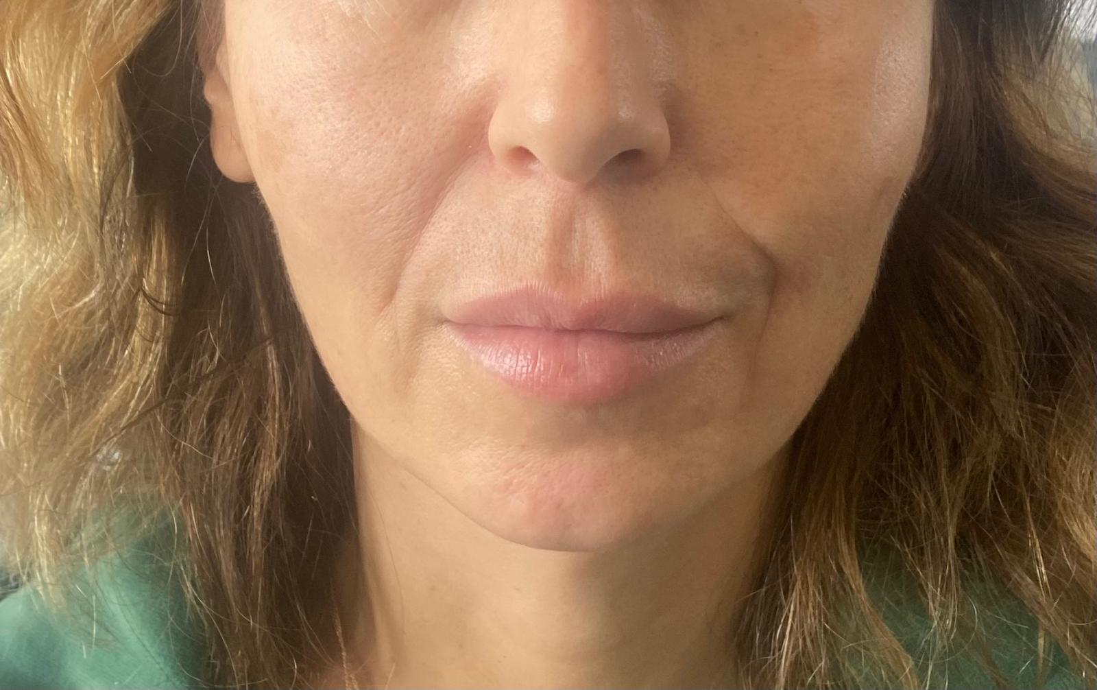 Regenerative & Biostimulatory Treatments