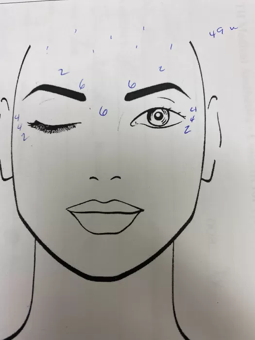 Facial mapping chart for neuromodulator planning