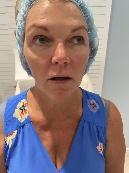 Skin assessment before treatment at Maison 58